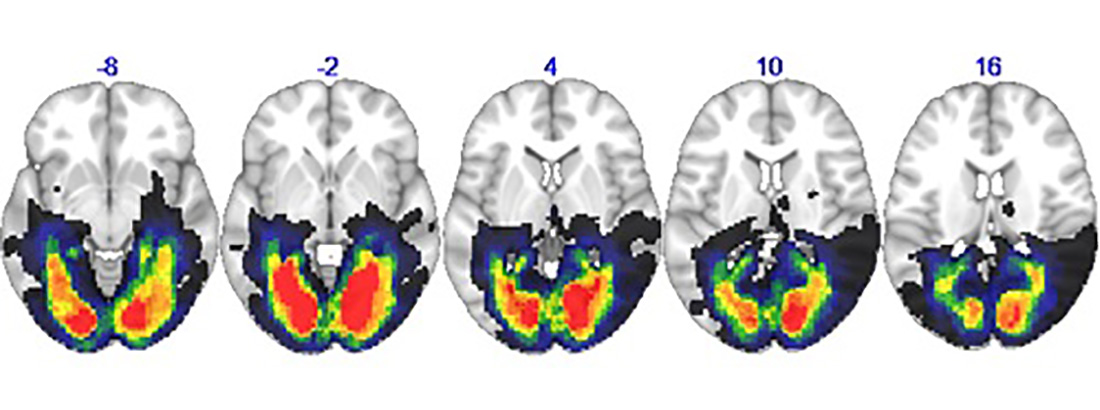 Image of brain scans